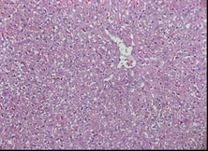 Rat liver with acute toxic hepatitis: hydropic degeneration and necrosis of hepatocytes. ?200