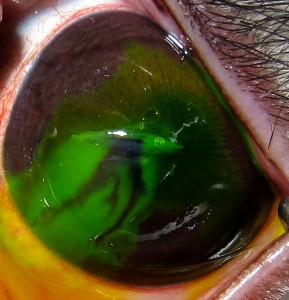 Model of cornea trauma in a rabbit. Positive test of Zeydel - dehiscence and outflow of aqueous humor from the forward camera to the anterior chamber of eye. Fluorescein staining