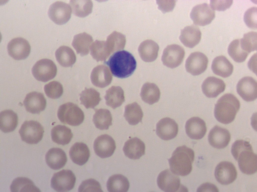 Лимфоцит в мазке крови крысы