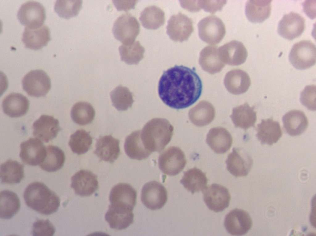 Лимфоцит в мазке периферической крови крысы